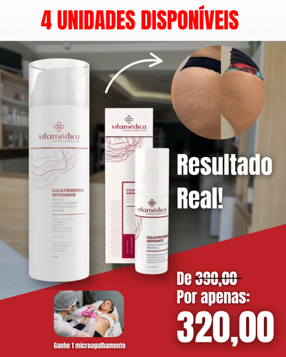 Kit Relive Skin – Tratamento Avançado para Estrias