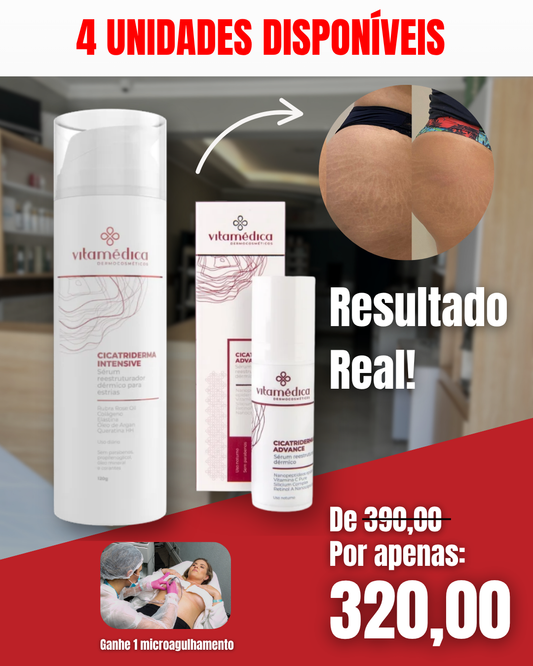 Kit Relive Skin – Tratamento Avançado para Estrias